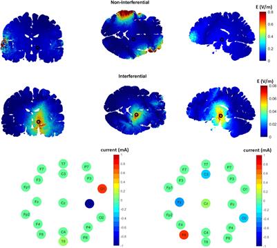 A Computational Modeling Study to Investigate the Use of Epicranial Electrodes to Deliver Interferential Stimulation to Subcortical Regions